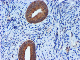 TIMP2 Antibody in Immunohistochemistry (Paraffin) (IHC (P))