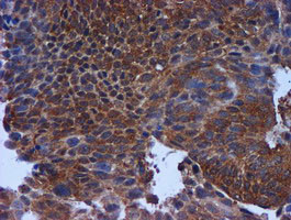 TIMP2 Antibody in Immunohistochemistry (Paraffin) (IHC (P))