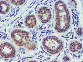 TIMP2 Antibody in Immunohistochemistry (Paraffin) (IHC (P))