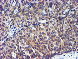 TIMP2 Antibody in Immunohistochemistry (Paraffin) (IHC (P))