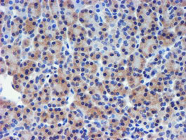 TIMP2 Antibody in Immunohistochemistry (Paraffin) (IHC (P))