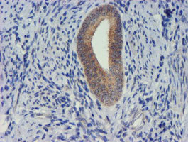 TIMP2 Antibody in Immunohistochemistry (Paraffin) (IHC (P))