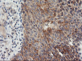 TIMP2 Antibody in Immunohistochemistry (Paraffin) (IHC (P))