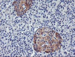 TIMP2 Antibody in Immunohistochemistry (Paraffin) (IHC (P))