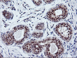 TIMP2 Antibody in Immunohistochemistry (Paraffin) (IHC (P))