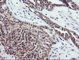 TIMP2 Antibody in Immunohistochemistry (Paraffin) (IHC (P))