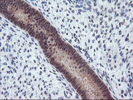 TIMP2 Antibody in Immunohistochemistry (Paraffin) (IHC (P))