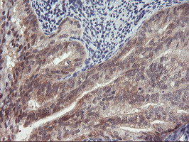 TIMP2 Antibody in Immunohistochemistry (Paraffin) (IHC (P))