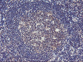 TIMP2 Antibody in Immunohistochemistry (Paraffin) (IHC (P))