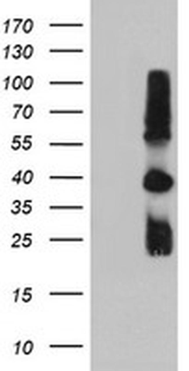 TIMP2 Antibody in Western Blot (WB)