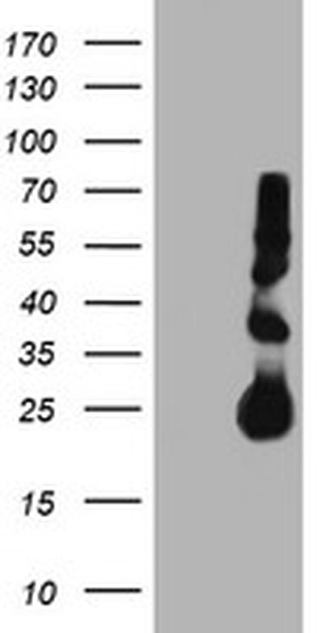 TIMP2 Antibody in Western Blot (WB)