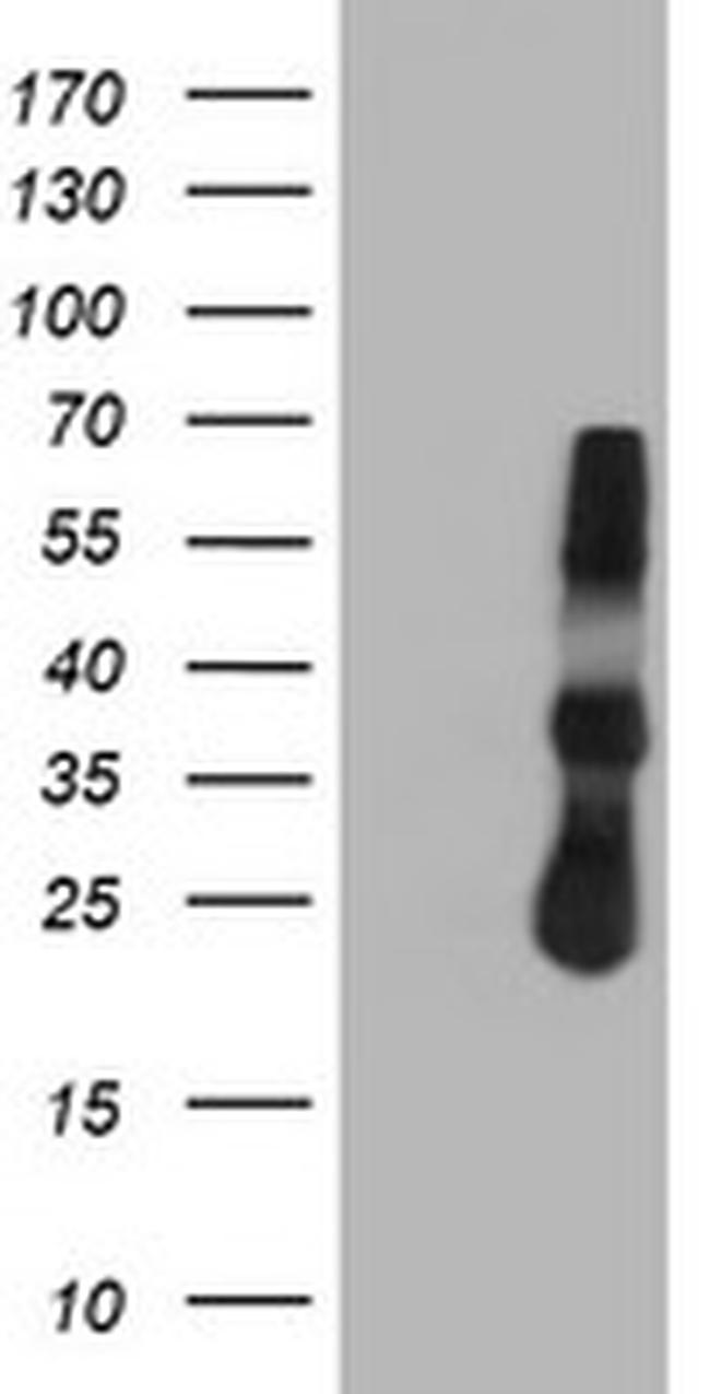 TIMP2 Antibody in Western Blot (WB)