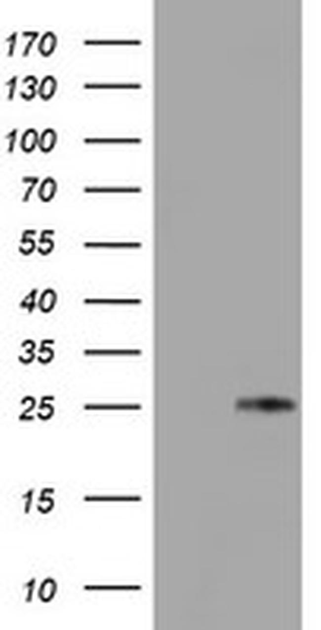 TIMP2 Antibody in Western Blot (WB)