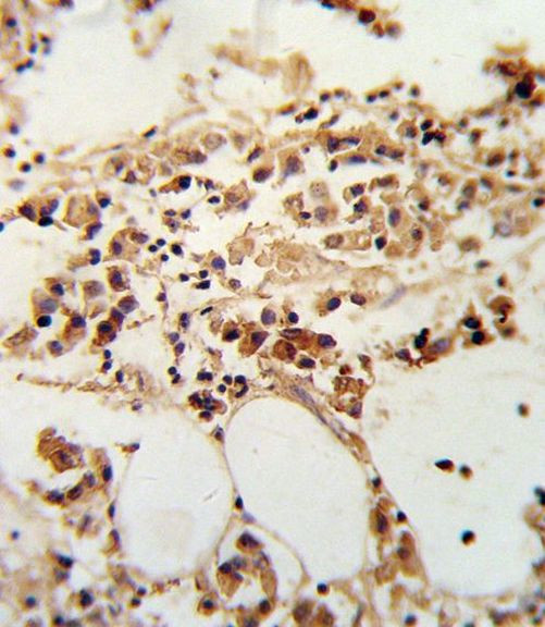 TIMP3 Antibody in Immunohistochemistry (IHC)