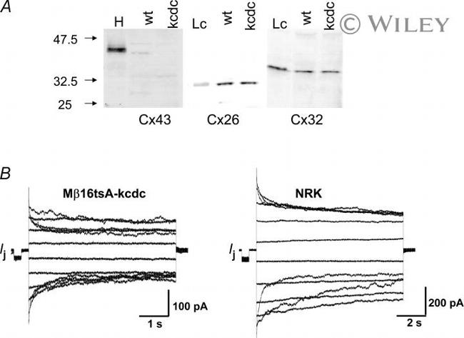 Connexin 26 Antibody in Western Blot (WB)