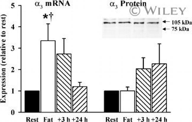 ATP1A3 Antibody in Western Blot (WB)