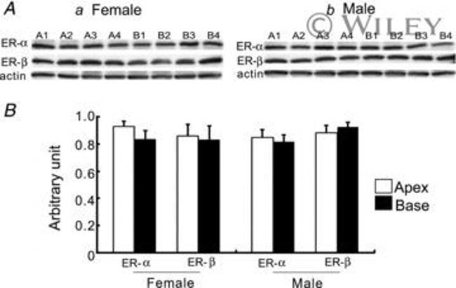 Estrogen Receptor alpha Antibody in Western Blot (WB)