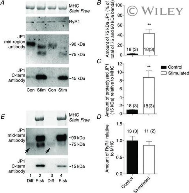 JPH1 Antibody in Western Blot (WB)