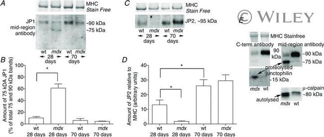 JPH2 Antibody in Western Blot (WB)