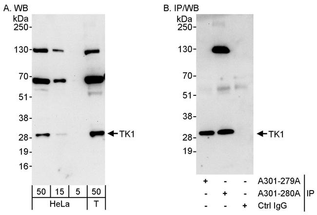 TK1 Antibody in Western Blot (WB)