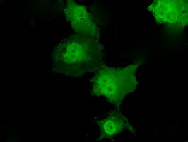 TKT Antibody in Immunocytochemistry (ICC/IF)