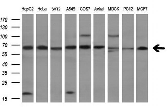 TKT Antibody in Western Blot (WB)