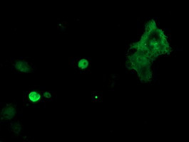 TLE1 Antibody in Immunocytochemistry (ICC/IF)