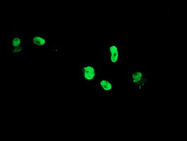 TLE1 Antibody in Immunocytochemistry (ICC/IF)