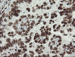 TLE1 Antibody in Immunohistochemistry (Paraffin) (IHC (P))