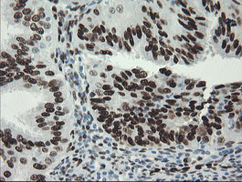 TLE1 Antibody in Immunohistochemistry (Paraffin) (IHC (P))