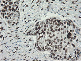 TLE1 Antibody in Immunohistochemistry (Paraffin) (IHC (P))