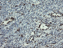 TLE1 Antibody in Immunohistochemistry (Paraffin) (IHC (P))