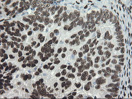 TLE1 Antibody in Immunohistochemistry (Paraffin) (IHC (P))