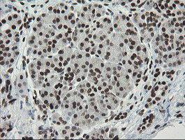 TLE1 Antibody in Immunohistochemistry (Paraffin) (IHC (P))