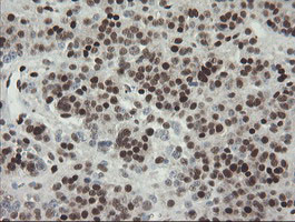 TLE1 Antibody in Immunohistochemistry (Paraffin) (IHC (P))