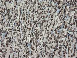 TLE1 Antibody in Immunohistochemistry (Paraffin) (IHC (P))