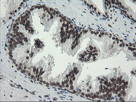 TLE1 Antibody in Immunohistochemistry (Paraffin) (IHC (P))