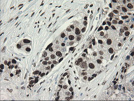 TLE1 Antibody in Immunohistochemistry (Paraffin) (IHC (P))