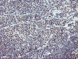 TLE1 Antibody in Immunohistochemistry (Paraffin) (IHC (P))