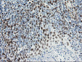 TLE1 Antibody in Immunohistochemistry (Paraffin) (IHC (P))