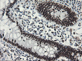 TLE1 Antibody in Immunohistochemistry (Paraffin) (IHC (P))