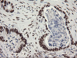 TLE1 Antibody in Immunohistochemistry (Paraffin) (IHC (P))