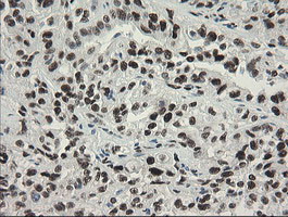 TLE1 Antibody in Immunohistochemistry (Paraffin) (IHC (P))