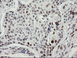 TLE1 Antibody in Immunohistochemistry (Paraffin) (IHC (P))