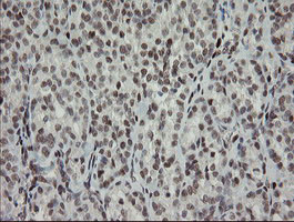 TLE1 Antibody in Immunohistochemistry (Paraffin) (IHC (P))