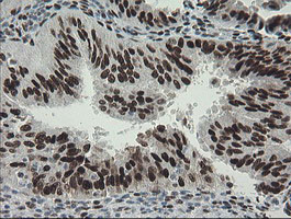 TLE1 Antibody in Immunohistochemistry (Paraffin) (IHC (P))