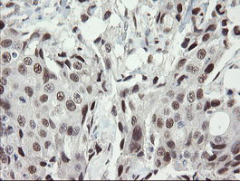 TLE1 Antibody in Immunohistochemistry (Paraffin) (IHC (P))