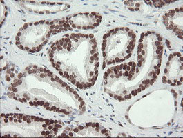 TLE1 Antibody in Immunohistochemistry (Paraffin) (IHC (P))