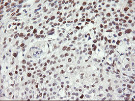 TLE1 Antibody in Immunohistochemistry (Paraffin) (IHC (P))