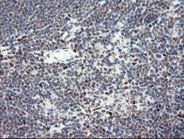 TLE1 Antibody in Immunohistochemistry (Paraffin) (IHC (P))